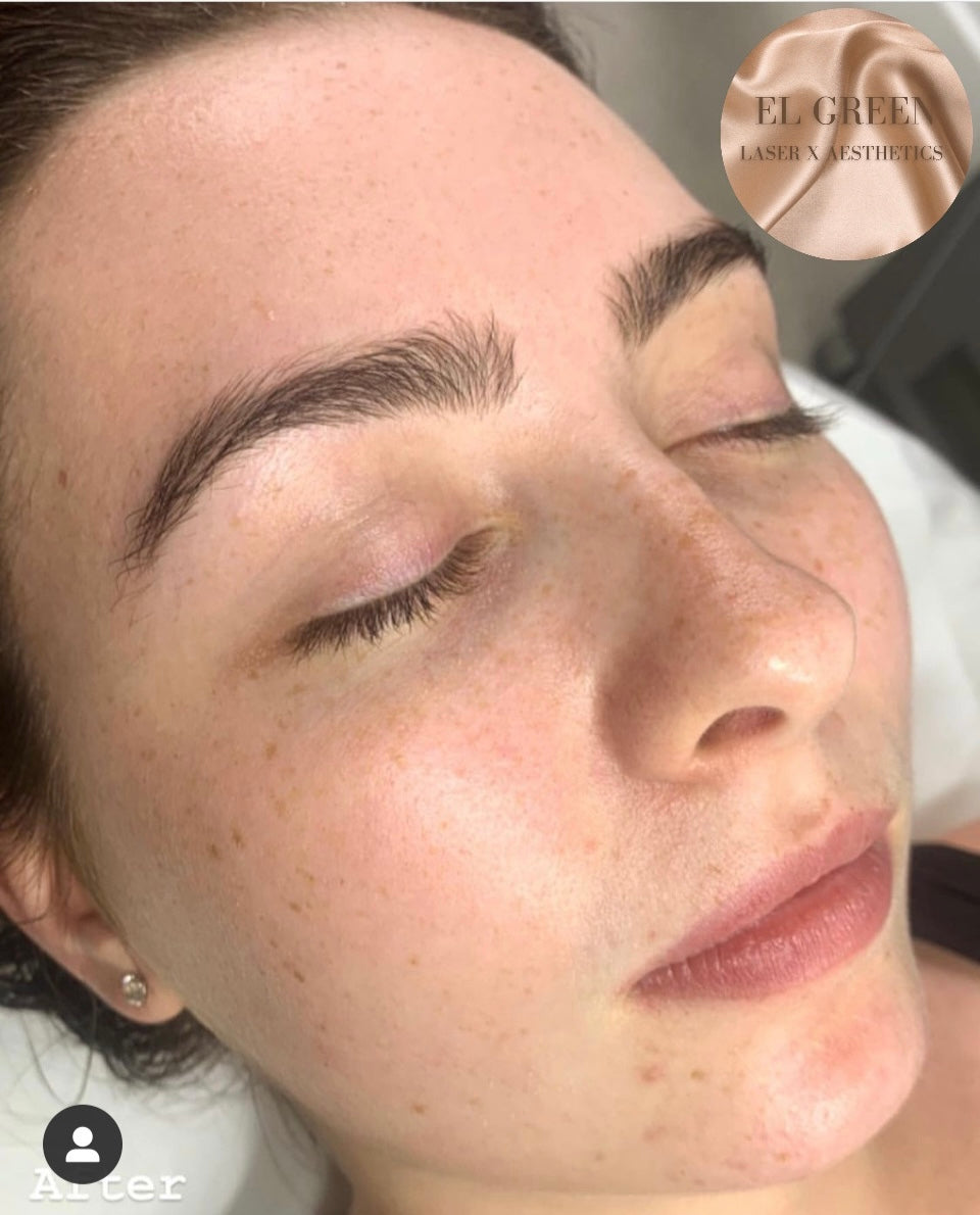 Aesthetic Facials Treatments - EMS Sculpt (30 Mins)