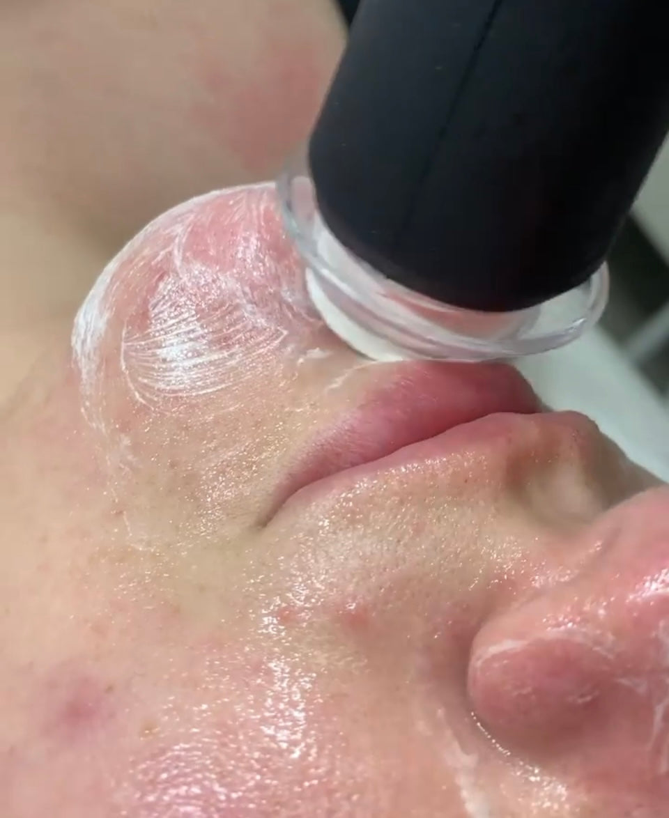 Aesthetic Facials Treatments - Pure Hydro (60 Mins)